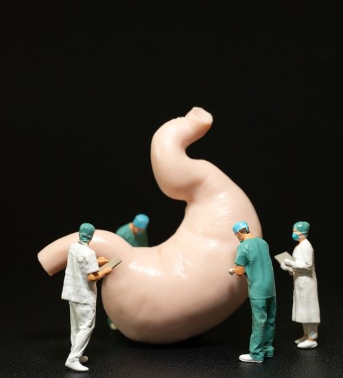 miniature-surgeons-scrubs-performing-operation-large-model-human-stomach-1.jpg